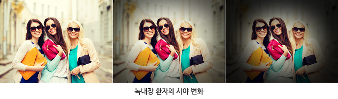 이미지명
