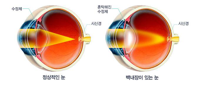 이미지명
