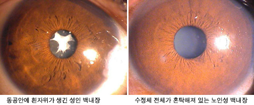 이미지명